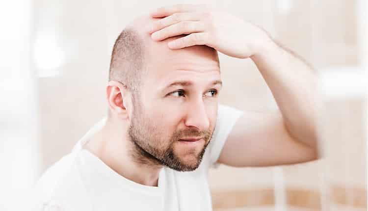 روش های کاشت مو با بانک موی ضعیف کدامند؟