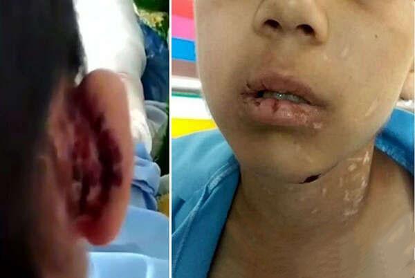 کودک آزار سبزواری متواری است ، کودک در بیمارستان بستری شد